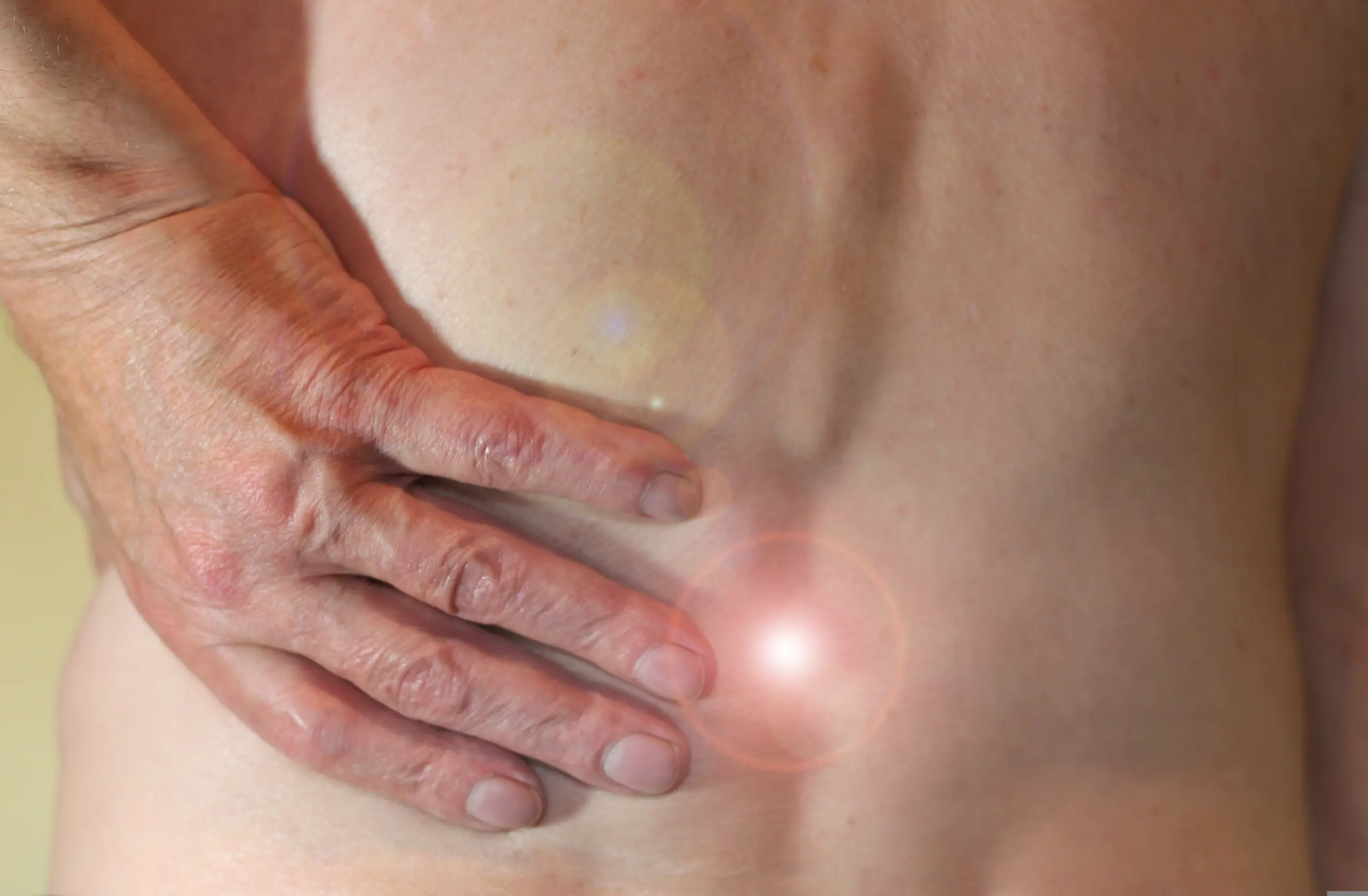 Dry needling treatment at Newington Spine & Joint.